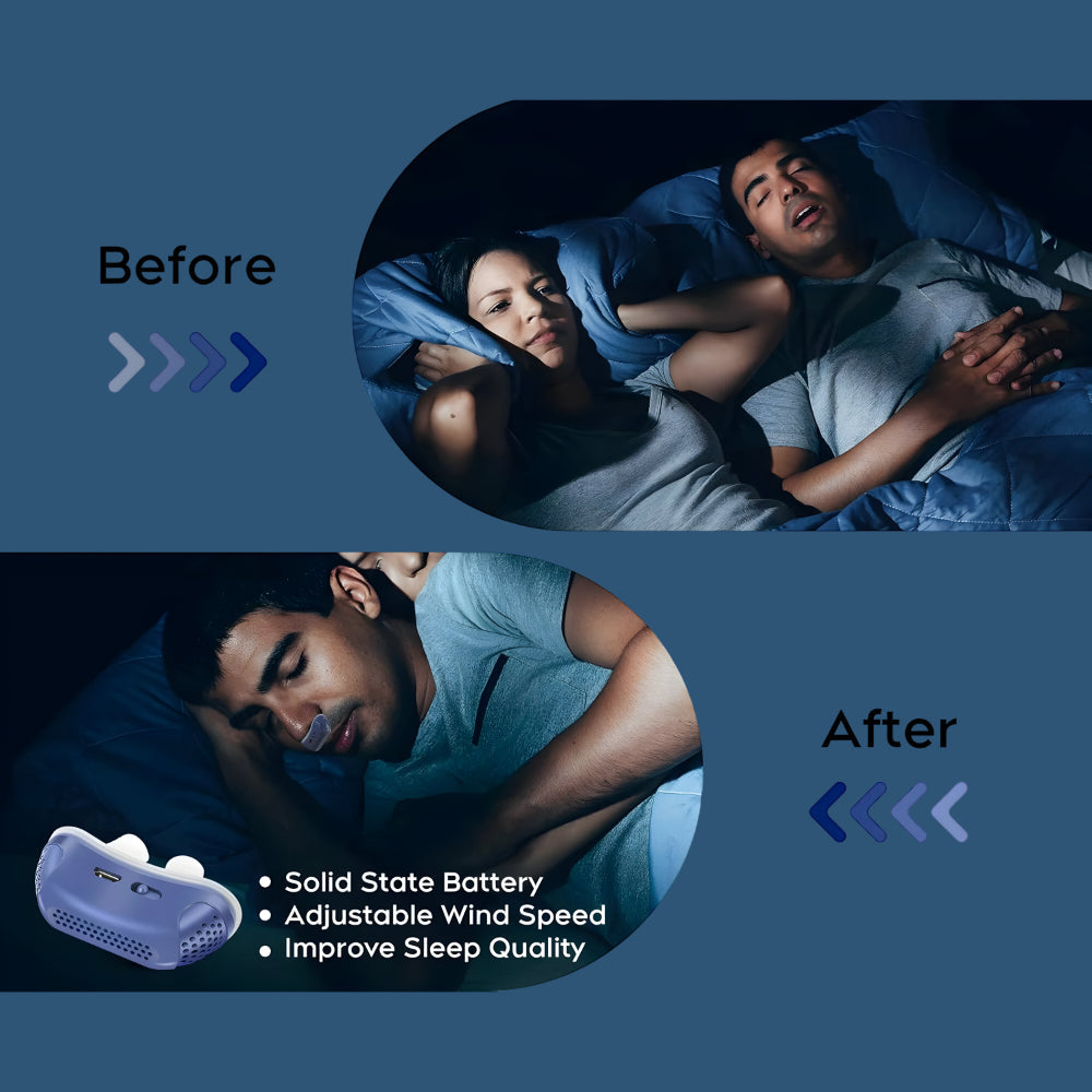 Silicone Breathing Nasal Aid For Snoring Relief And Sleep