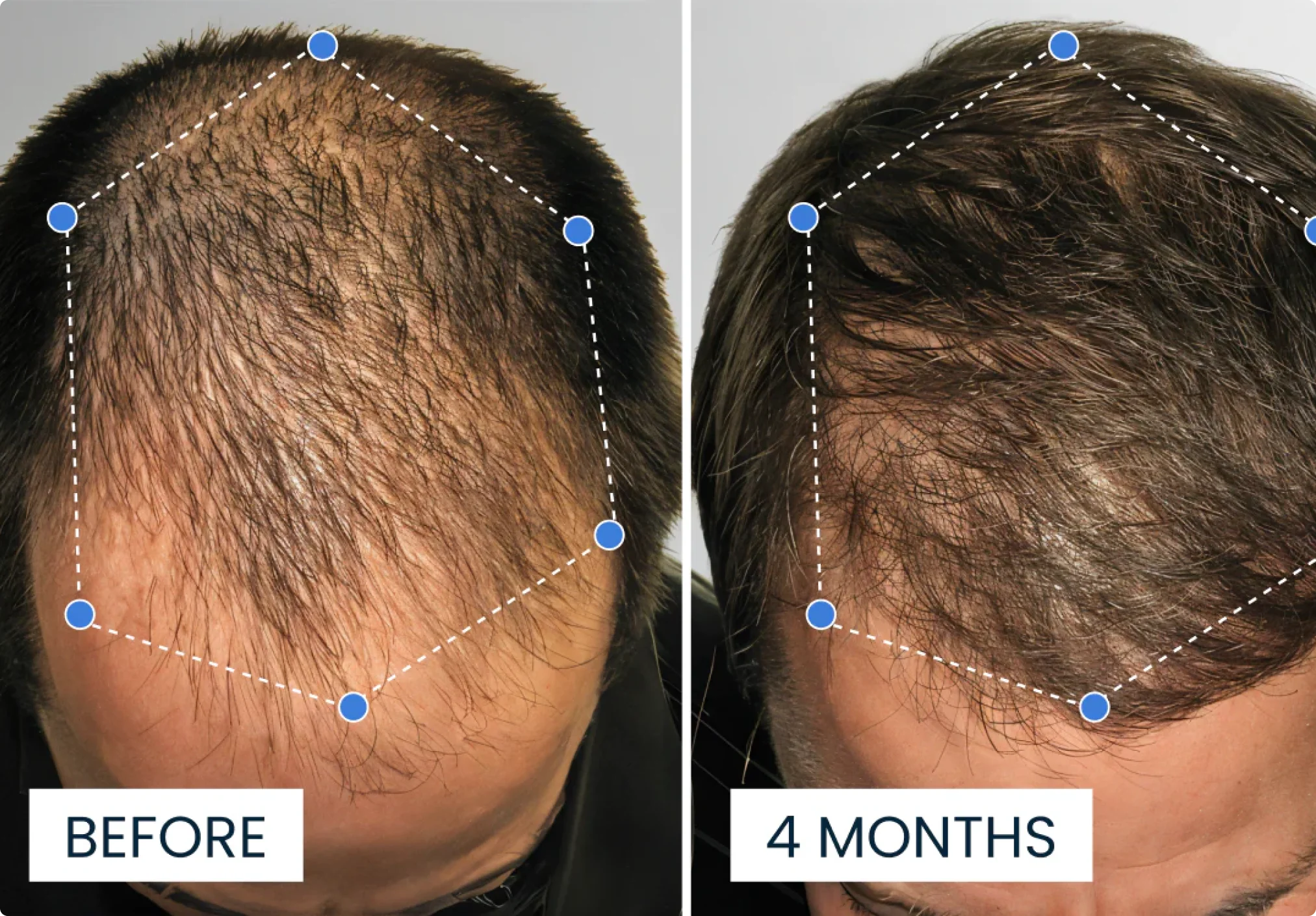 Duo med kobberpeptid shampoo og balsam til hovedbundens velvære og stærkere udseende hår