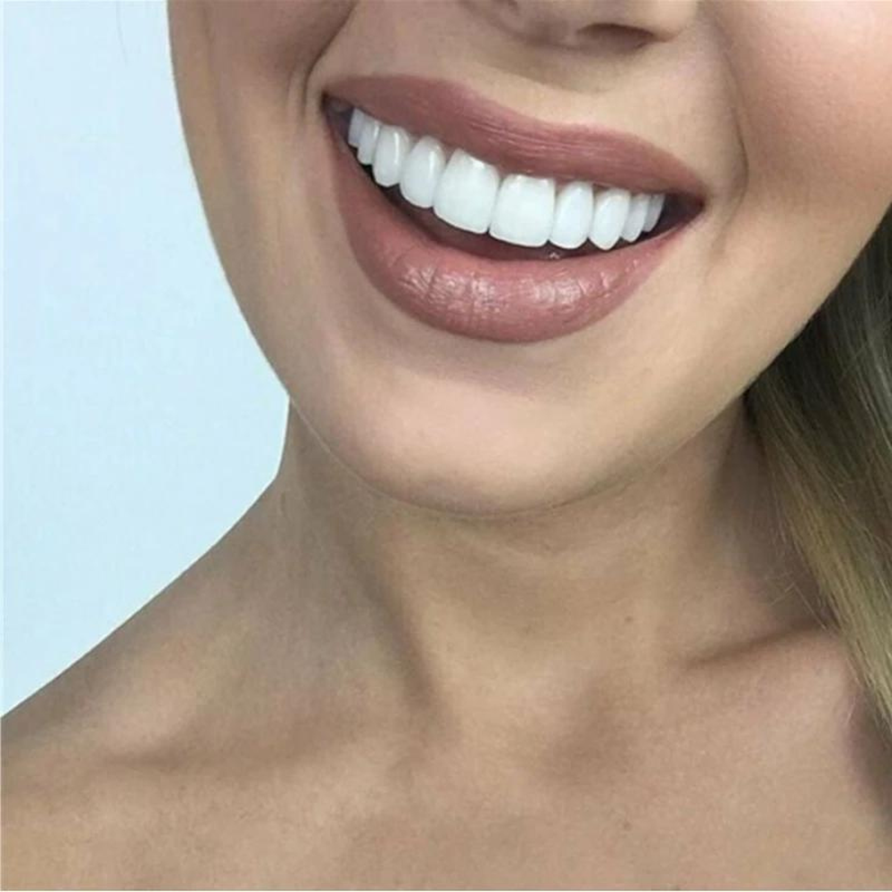 EverBright Tooth Repair Brighten And Align Your Smile